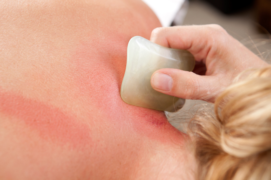 Redness during Gua Sha